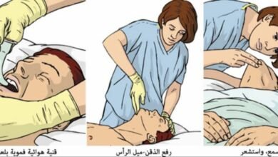 Photo of الإسعافات الأولية للحوادث..وإنقاذ حياة إنسان First aids for accidents