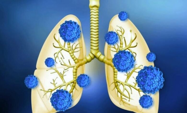 تأثير فيروس كورونا على الجهاز التنفسي