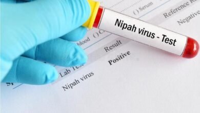 Photo of نيباه فيروس Nipah virus فتاك جديد يظهر في الصين