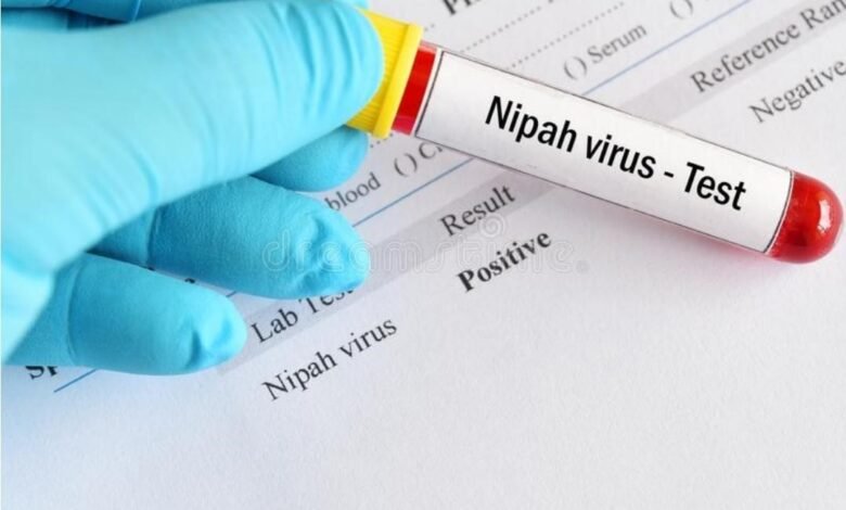 نيباه فيروس Nipah virus