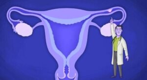 الحمل خارج الرحم 